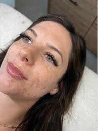 Located in Uptown Greenwood 📍 Offering individual eyelash extensions,  dermaplaning, chemical peels, 1 hour customized facials including massage,  and brow wax & tints