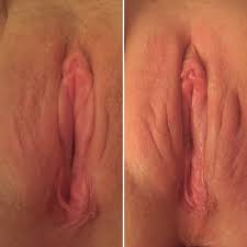 My Wife - A different kind of OnOff pic. Before and after her monthly waxing  Porn Pic - EPORNER