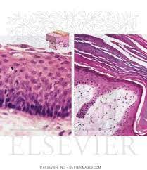 Check spelling or type a new query. Light Micrograph Of Nonkeratinized Stratified Squamous Epithelium In The Oral Cavity And Keratinized Stratified Squamous Epithelium