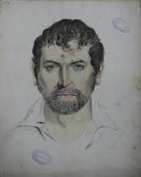 The Enigma of Dublin's First Skin Disease Expert