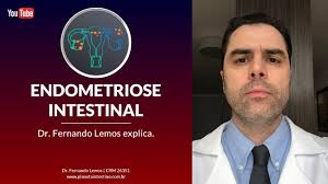 Endometriose Intestinal! Dr. Fernando Lemos explica.
