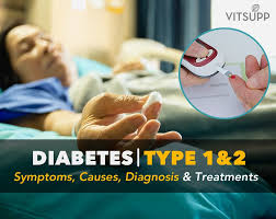 Insulin is not required for survival in type 2 diabetes. Diabetes Type 1 Type 2 Symptoms Causes Treatment Prevention