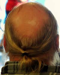 Bald Guy With Ponytail But Why Funny Family Photos Guys With Ponytails Bald Men