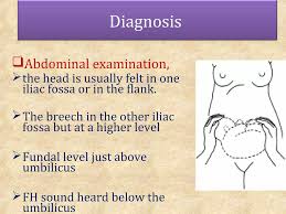 Image result for Shoulder Presentation