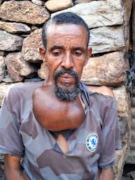 ሓያልሰብ ትግራይ ንዘለኣለም ትነብር