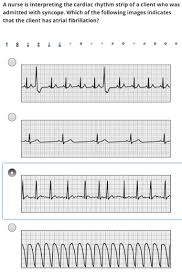 Solved A Nurse Is Interpreting The Cardiac Rhythm Strip O Chegg Com
