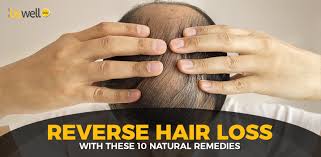 Yogurt and oil together can make an effective home treatment for dry hair. 10 Natural And Effective Hair Loss Treatments L Bewell Buzz