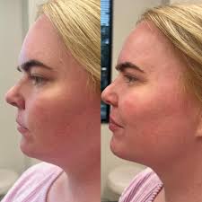 ReviveLifeStyleMedicine (@revivelifestylemedicine) • Instagram photos and  videos