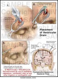 Pin On Nursing