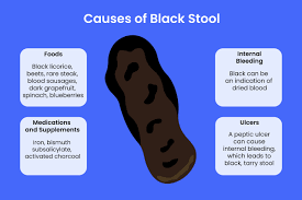 Image result for blood in stool human poop