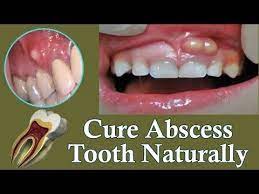 Pin On Healthy Gum Tips