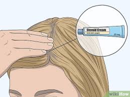 3 Easy Ways To Treat An Itchy Scalp After Using Hair Dye Wikihow