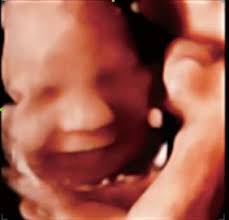 ПРЕНАТАЛЬНАЯ ДИАГНОСТИКА