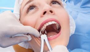 Image result for Tooth Extraction