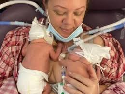 Gemelos Fantásticos: nacieron prematuros y no tenían chances de vida, pero  se recuperan y asombran al mundo