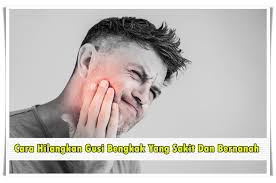 Siapapun yang pernah mengalami gigi berlubang sampai gigi busuk gusi bengkak dan gusi. Cara Hilangkan Gusi Bengkak Yang Sakit Dan Bernanah