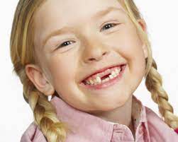 Pasti ramai tahu sebelum ini, pelakon wawa zainal pernah meluahkan rasa bimbang mengenai masalah gigi dua orang anaknya iaitu ahmad fakhruddin attar dan hayla maghfiratul adzkiyaa. Gigi Palsu Dan 4 Hal Penting Sebelum Menggunakan Gigi Palsu