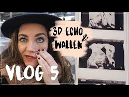 3D Echo, HALLO WALLEN & Staycation boek