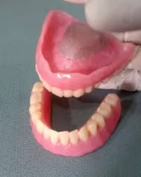 Alasan menggunakan gigi palsu sebelum kita membahas mengenai harga gigi palsu atau gigi tiruan, tentunya kita harus tau dulu alasannya kenapa harus menggunakan gigi palsu atau gigi tiruan. Tukang Gigi Borneo Posts Facebook