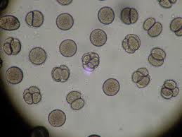 Maybe you would like to learn more about one of these? How Are Plant Cells Different Than Fungi Cells Earth Com