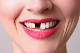 Maybe you would like to learn more about one of these? 7 Mitos Arti Mimpi Gigi Copot Lekat Dengan Pertanda Kematian