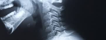 Please understand that our phone lines must be clear for urg. Neck X Ray