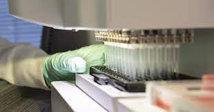 In un farmaco già in uso per il parkinson, la rotigotina, una possibilità terapeutica per i malati di alzheimer: P3qvwok9hrg3um