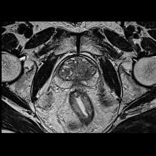 Mri Iscan Diagnostic Center