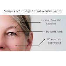 Immediately after your treatment, you will look as though you have a moderate to severe sunburn and your skin may feel warm and tighter than usual. Nano Needling Skin Rejuvenation Progressive Laser Ny