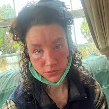 My skin is constantly