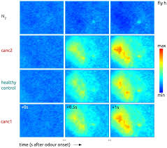 Almost all airport metal detectors are based on pulse induction (pi). More Than Apples And Oranges Detecting Cancer With A Fruit Fly S Antenna Scientific Reports