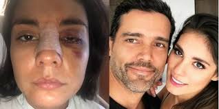 La actriz Eileen Moreno relata cómo su novio, el actor Alejandro García, la  golpeó