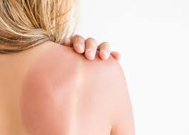 Certaines peaux sont plus sensibles que d'autres : 4pmkmcxv016u M