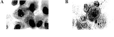 Image result for Callilepis laureola