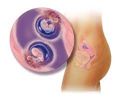 If your dates were off and the babies are fine then at another ultrasound in a few days/weeks will tell you that, or that they are not growing, etc. Twins Fetal Development Month By Month Babycenter