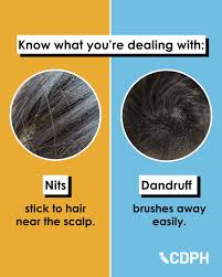 Image result for lice vs dandruff