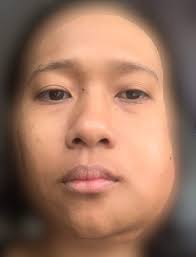 Tunggu beberapa ssaat dan terus hilang sakit gigi tadi. Cabut Gigi Sampai Kena Warded Athirahassin