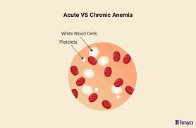 Image result for Anemia