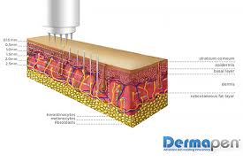 Dermapen Micro Needling Treatments Luscious Lash Skin