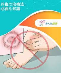 丹毒に関する必要な知識 みんな健康 知識 健康 スキンケア