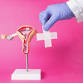 Ring Pessary Fitting and Prolapse Management PM event in Watlington