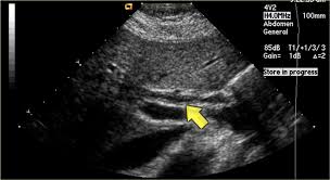 Pin On Liver