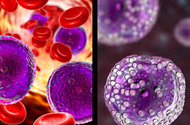 Blood cancer is a type of malignancy which affects the blood, bone marrow, or lymphatic system. Are Leukemia And Lymphoma The Same Thing Health Essentials From Cleveland Clinic