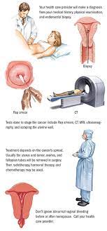 These signs can change depending on the growth of the cancer. Uterine Endometrial Cancer Spectrum Health