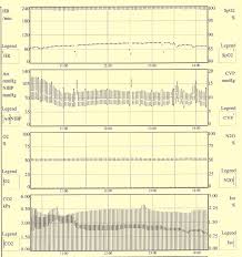 patient intraoperative anaesthetic monitoring chart