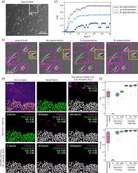 · updated may 15, 2020. Democratising Deep Learning For Microscopy With Zerocostdl4mic Nature Communications