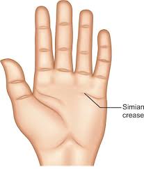 Langer'S Lines - Wikipedia