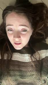 Renee Winter Nurse Fill The Sample