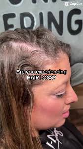 Are you experiencing HAIR LOSS? Message us for a VIRTUAL Consultation! We  can’t wait to help you! #jnielfringe #hairdreams #hairloss #hairtopper  #thinninghair #thinnhairsolutions #hairtoppers ...