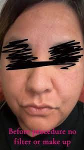 University of Michigan Health-West, 4285 Parkway Place Dr SW, Grandville,  MI 49418, US